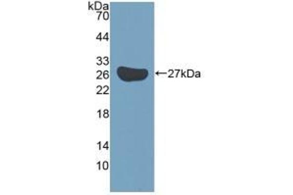 KATNA1 antibody  (AA 260-491)