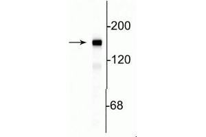 Image no. 2 for anti-Neurofilament Triplet M Protein (NEFM) (C-Term) antibody (ABIN361355)