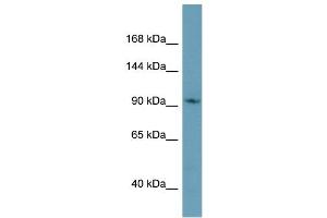 Image no. 1 for anti-Cap Methyltransferase 1 (CMTR1) (C-Term) antibody (ABIN2786076)