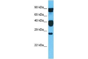 Image no. 1 for anti-GLI Pathogenesis-Related 1 Like 2 (GLIPR1L2) (C-Term) antibody (ABIN2791969)