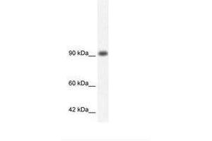 Image no. 3 for anti-RNA Binding Motif Protein 10 (RBM10) (AA 79-128) antibody (ABIN202953)