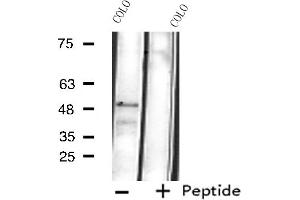 Image no. 2 for anti-Cytochrome P450, Family 4, Subfamily B, Polypeptide 1 (CYP4B1) antibody (ABIN6258392)