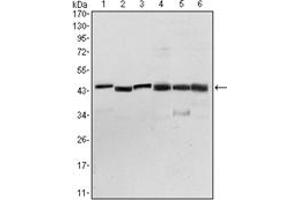 Image no. 3 for anti-3-phosphoinositide Dependent Protein Kinase-1 (PDPK1) antibody (ABIN1108608)