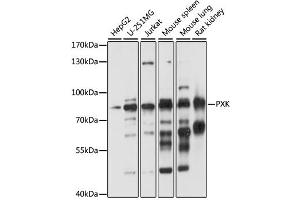 Image no. 1 for anti-PX domain-containing protein kinase-like protein (PXK) antibody (ABIN6568713)