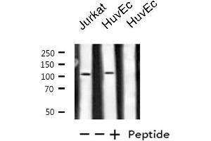 Image no. 3 for anti-Protein Kinase N1 (PKN1) antibody (ABIN6257420)