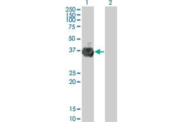 anti-Ring Finger and FYVE-Like Domain Containing 1 (RFFL) (AA 2-99) antibody
