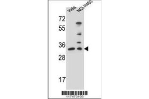 Image no. 1 for anti-Nth Endonuclease III-Like 1 (NTHL1) (AA 88-117) antibody (ABIN655501)