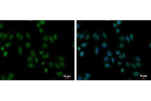 ICC/IF Image PABPN1 antibody detects PABPN1 protein at cytoplasm and nucleus by immunofluorescent analysis.