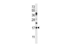 RNASE6 抗体  (C-Term)