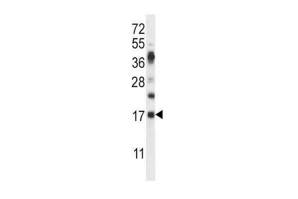 RNASE6 抗体  (C-Term)