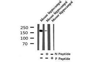Image no. 1 for anti-Afadin (MLLT4) (pTyr1230) antibody (ABIN6270062)