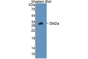 Image no. 1 for anti-ATP-Binding Cassette, Sub-Family F (GCN20), Member 2 (ABCF2) (AA 396-623) antibody (ABIN5013201)