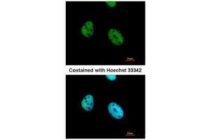 Image no. 1 for anti-Activating Transcription Factor 7 (AFT7) (C-Term) antibody (ABIN2855961)