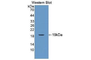 Image no. 1 for anti-CD160 (CD160) (AA 33-171) antibody (ABIN5013347)
