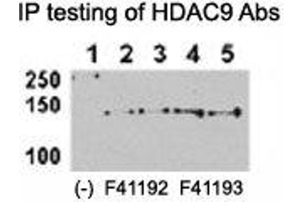 HDAC9 anticorps  (AA 2-32)
