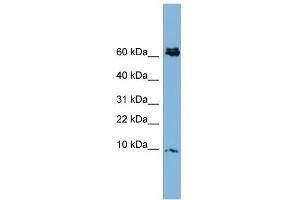 Image no. 1 for anti-Cysteine-Rich Protein 1 (Intestinal) (CRIP1) (N-Term) antibody (ABIN2784545)