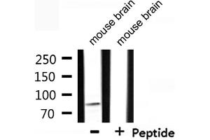 CDH15 anticorps  (N-Term)