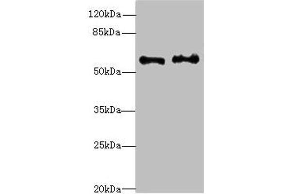 NMT2 anticorps  (AA 1-120)