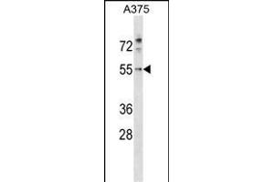 PDCD7 antibody  (C-Term)