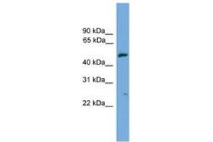 Image no. 1 for anti-Exocyst Complex Component 4 (EXOC4) (AA 71-120) antibody (ABIN6745615)