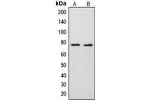 Western blot analysis of ARHGAP18 expression in MDAMB231 (A), U2OS (B) whole cell lysates.