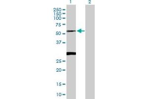 Image no. 2 for anti-Ceroid-Lipofuscinosis, Neuronal 3 (CLN3) (AA 1-438) antibody (ABIN514466)