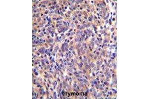 Image no. 1 for anti-Thymocyte Selection Associated (THEMIS) (AA 566-595), (C-Term) antibody (ABIN955183)