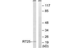 Image no. 1 for anti-Mitochondrial Ribosomal Protein S25 (MRPS25) (AA 124-173) antibody (ABIN1535023)