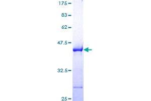 Image no. 1 for BCL2-Associated Athanogene (BAG1) (AA 241-345) protein (GST tag) (ABIN1346360)