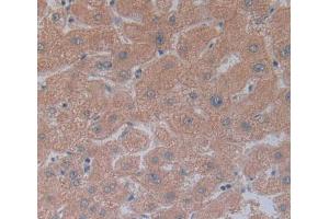 Image no. 3 for anti-Carcinoembryonic Antigen-Related Cell Adhesion Molecule 1 (Biliary Glycoprotein) (CEACAM1) (AA 35-320) antibody (ABIN1077901)