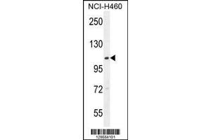 Image no. 1 for anti-Acyl-CoA Dehydrogenase Family, Member 10 (ACAD10) (AA 393-421) antibody (ABIN654760)