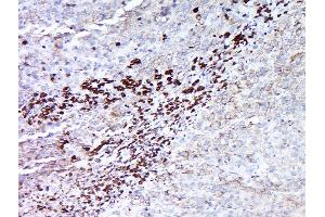 Image no. 1 for anti-Melanoma Antigen Family A, 5 (MAGEA5) (AA 41-124) antibody (ABIN721330)