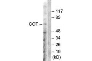 Image no. 3 for anti-Mitogen-Activated Protein Kinase Kinase Kinase 8 (MAP3K8) (AA 256-305) antibody (ABIN2888594)