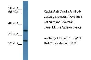 Image no. 1 for anti-Chloride Channel, Nucleotide-Sensitive, 1A (CLNS1A) (C-Term) antibody (ABIN2784698)