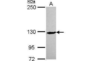 WB Image Sample (30 ug of whole cell lysate) A: IMR32 5% SDS PAGE antibody diluted at 1:500