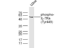 Image no. 2 for anti-Interleukin 7 Receptor (IL7R) (pTyr449) antibody (ABIN801438)