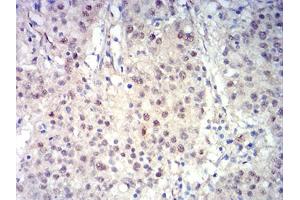 Image no. 6 for anti-B-Cell CLL/lymphoma 11B (Zinc Finger Protein) (BCL11B) (AA 1-150) antibody (ABIN5611301)