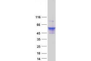 Image no. 1 for Lysophosphatidylcholine Acyltransferase 4 (LPCAT4) protein (Myc-DYKDDDDK Tag) (ABIN2714461)
