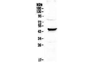 Image no. 5 for anti-Nephroblastoma Overexpressed (NOV) (AA 334-357), (C-Term) antibody (ABIN5518938)