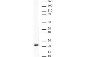 Image no. 1 for anti-MAD2 Mitotic Arrest Deficient-Like 1 (Yeast) (MAD2L1) antibody (ABIN6972303)