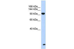 Image no. 1 for anti-Trinucleotide Repeat Containing 6B (TNRC6B) (N-Term) antibody (ABIN2778742)