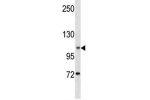 Image no. 1 for anti-Anoctamin 1, Calcium Activated Chloride Channel (ANO1) (AA 453-482) antibody (ABIN3028466)