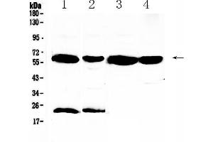 Image no. 1 for anti-UDP Glucuronosyltransferase 1 Family, Polypeptide A1 (UGT1A1) (AA 316-533) antibody (ABIN5693290)