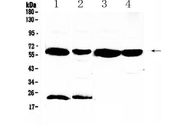 UGT1A1 Antikörper  (AA 316-533)