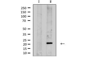 Image no. 1 for anti-Potassium Large Conductance Calcium-Activated Channel, Subfamily M, beta Member 1 (KCNMB1) antibody (ABIN6262754)