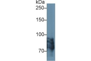 Image no. 2 for anti-Periostin (POSTN) (AA 500-630) antibody (ABIN1860279)