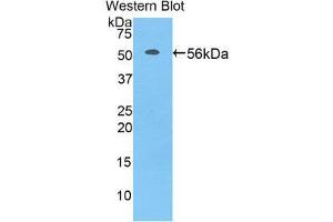 Image no. 1 for anti-Acidic (Leucine-Rich) Nuclear phosphoprotein 32 Family, Member A (ANP32A) (AA 2-247) antibody (ABIN1858013)