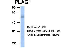 Image no. 2 for anti-Pleiomorphic Adenoma Gene 1 (PLAG1) (N-Term) antibody (ABIN2780443)