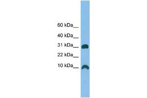 Image no. 1 for anti-Cysteine-Rich Protein 1 (Intestinal) (CRIP1) (Middle Region) antibody (ABIN2784546)