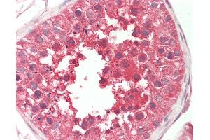 Image no. 1 for anti-Sperm Associated Antigen 9 (SPAG9) (AA 775-825) antibody (ABIN2628657)